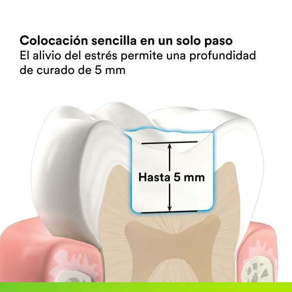 Composite Foto Filtek One Bulk Fill (Variedades)- Solventum - Imagen 3